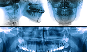 orthodontiste lille CABINET D'ORTHODONTIE Dr Gaspard Toutain et Dr Héloïse Beck