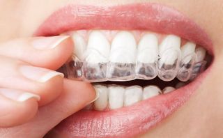 orthodontiste montpellier SCM Mauran-Plas