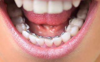 orthodontiste montpellier SCM Mauran-Plas